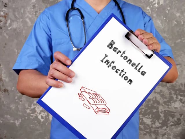 Bartonella objawy psychiczne: niebezpieczne skutki, które musisz znać Bartonella objawy psychiczne: niebezpieczne skutki, które musisz znać